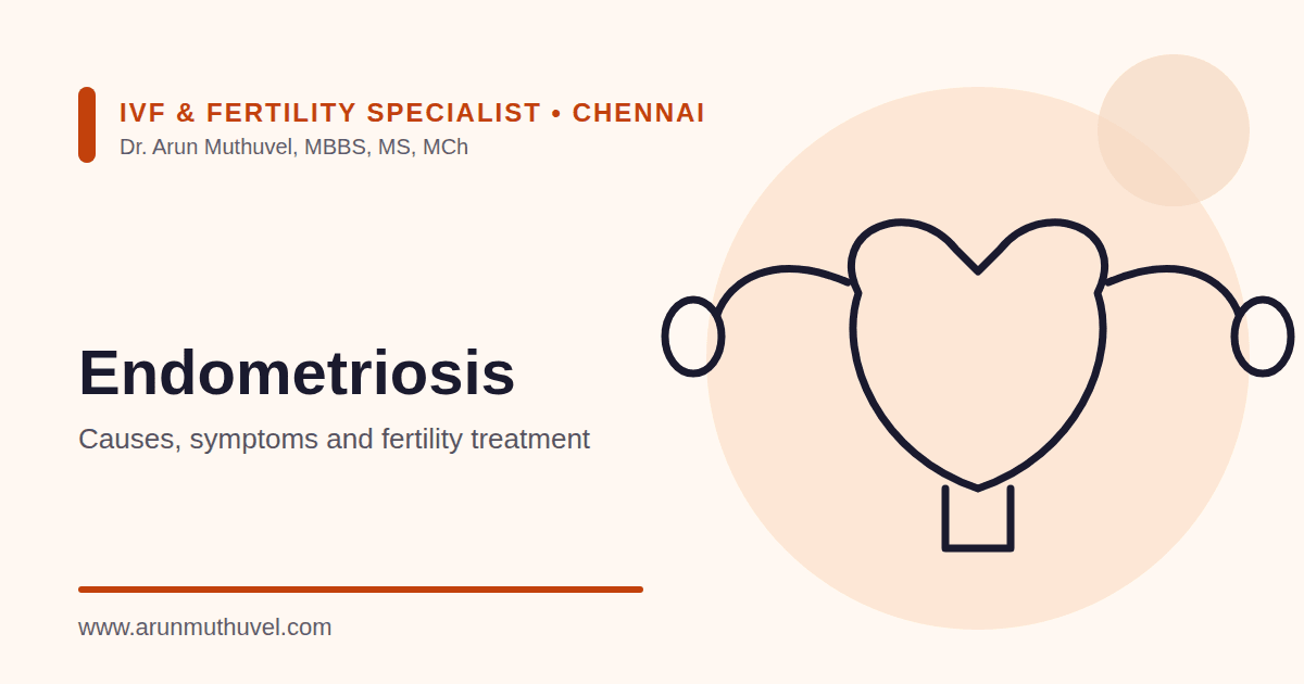 Illustration of the uterus representing endometriosis