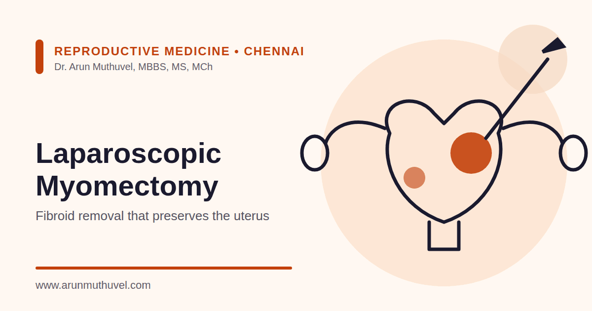 Illustration of laparoscopic myomectomy showing fibroids in the uterine wall and a keyhole instrument