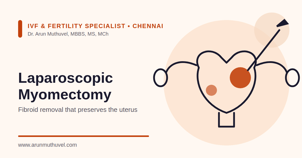 Laparoscopic Myomectomy in Chennai – Dr. Arun Muthuvel