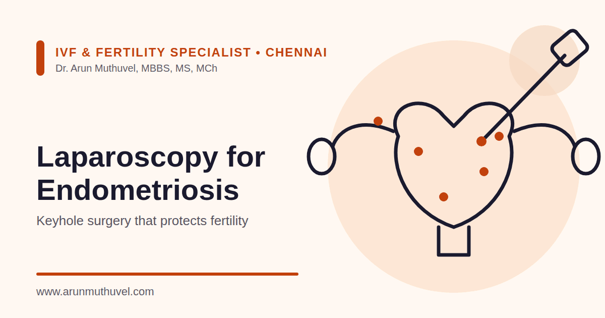 Laparoscopy for Endometriosis in Chennai – Dr. Arun Muthuvel