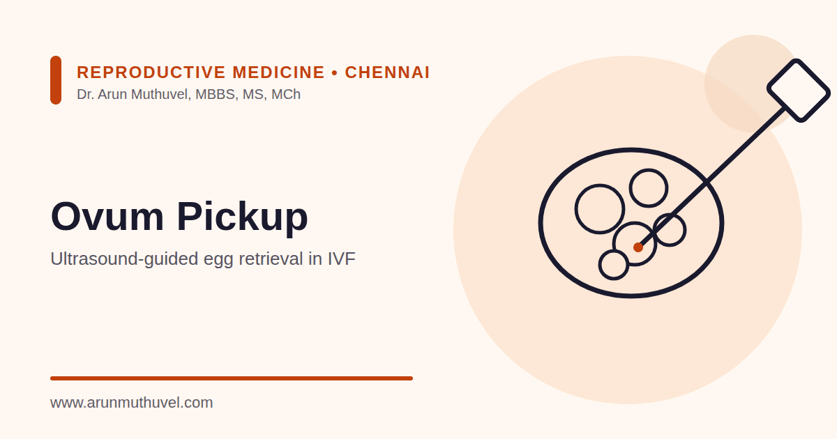 Illustration of ovum pickup showing an ultrasound-guided needle aspirating follicles from the ovary
