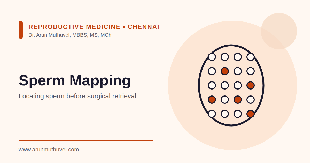 Illustration of sperm mapping showing a grid of fine-needle aspiration sites on the testicle with positive sites highlighted