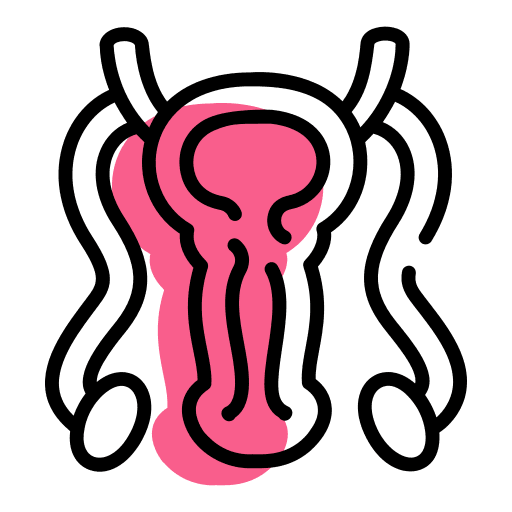 Micro TESE Procedure